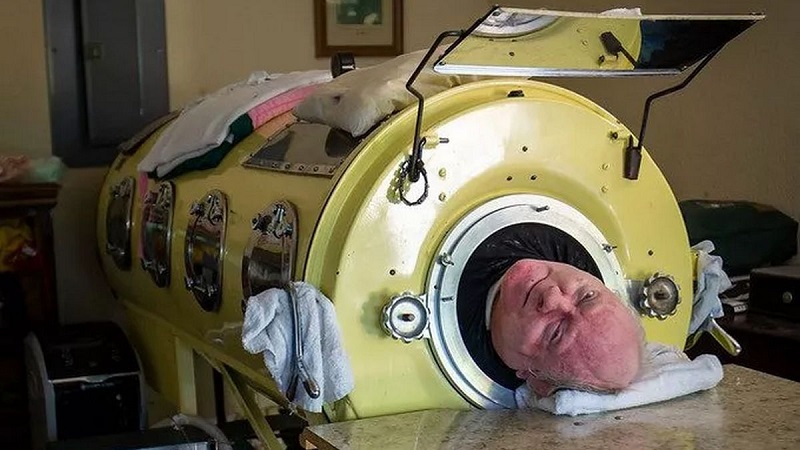 'The man in the iron lung' passes away aged 78