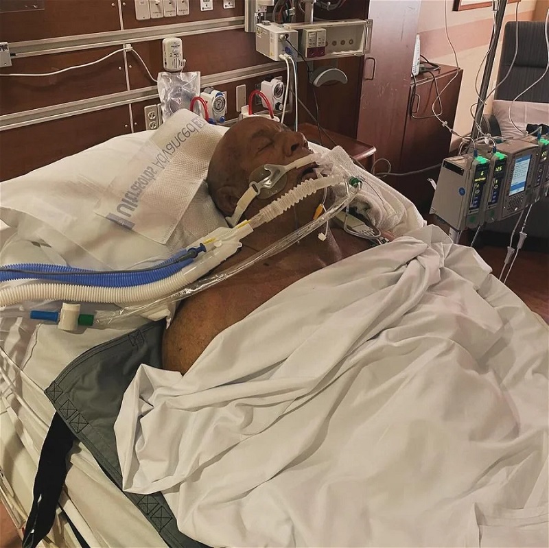 Retired Ultimate Fighting Championship (UFC) fighter Mark Coleman was hospitalised after rescuing his parents from a house fire in Toledo, located in the state of Ohio, United States (US).