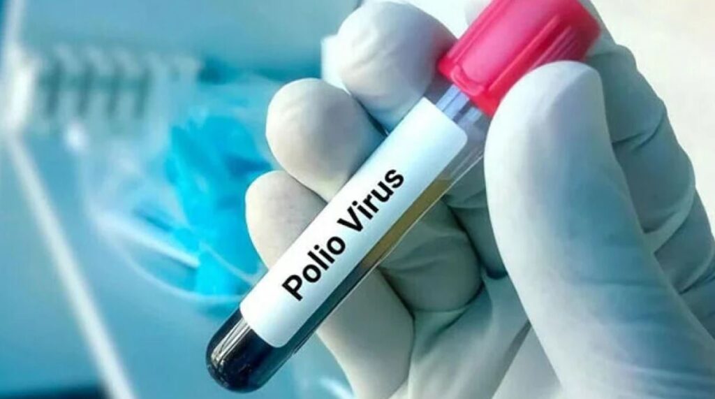 Polio cases