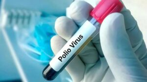 Polio cases