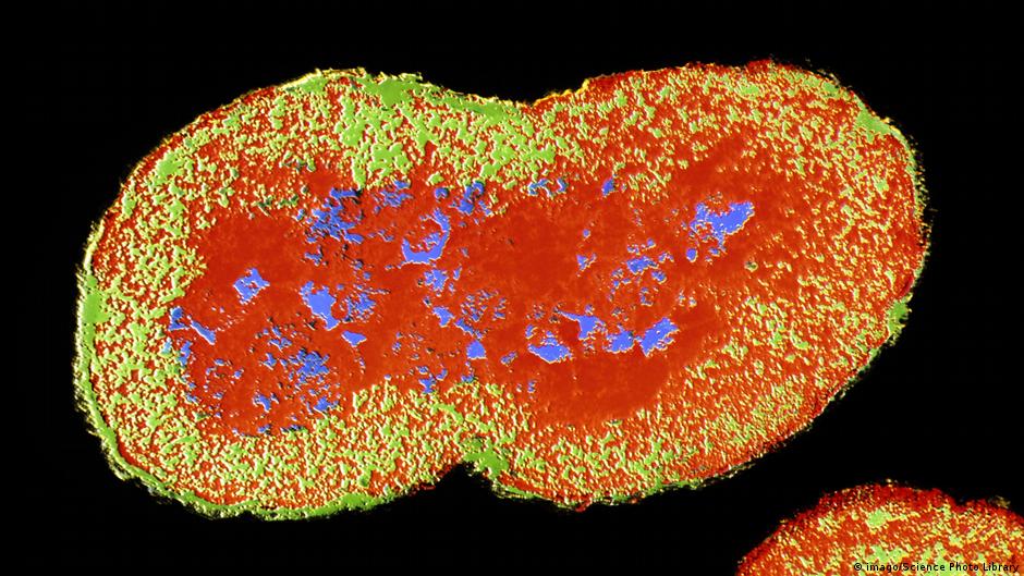 The Neisseria gonorrhea bacterium: Most women who get the STI gonorrhea are asymptomatic, which puts them at higher risk than men, who unmistakably know when they've got it