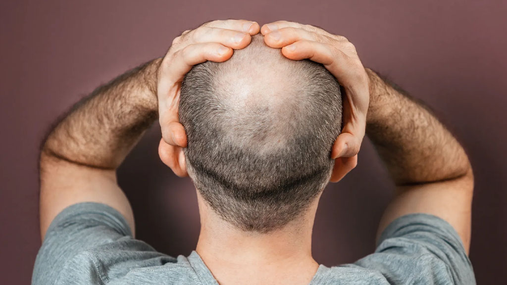 hair loss new treatment