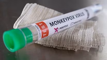 Mpox virus in Pakistan