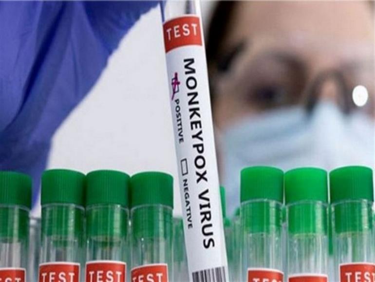 Monkeypox Karachi