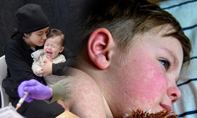 Measles Outbreak