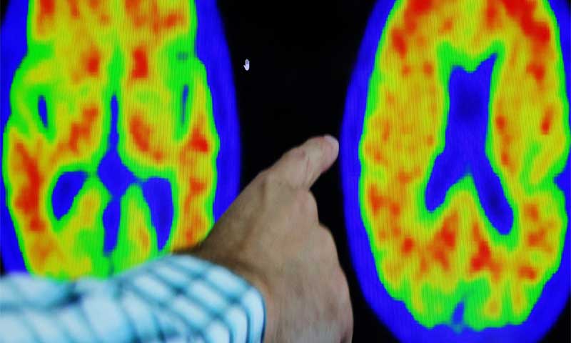 Human brain's new stages of development