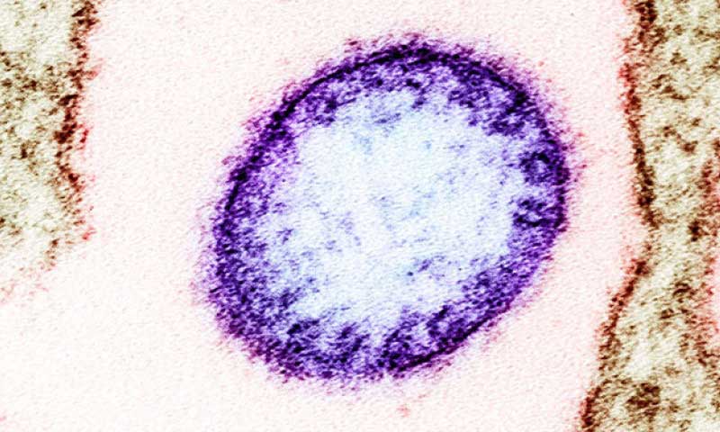 Niphah Virus