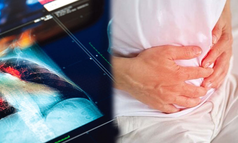 11 types of cancer among under-50s revealed, concern raises among younger adults: Study