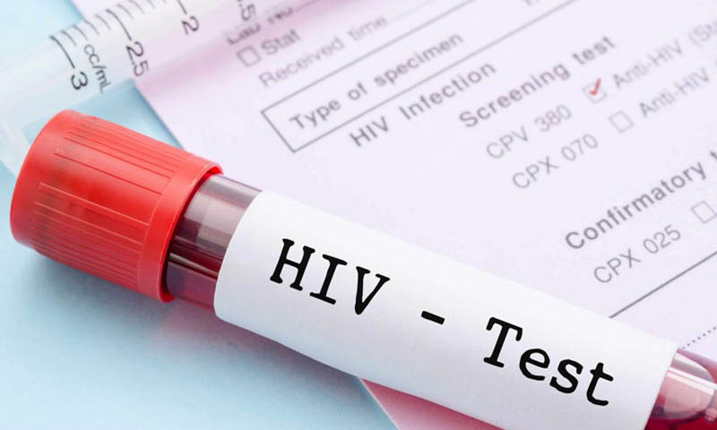 Islamabad reports 618 new HIV cases since 2025