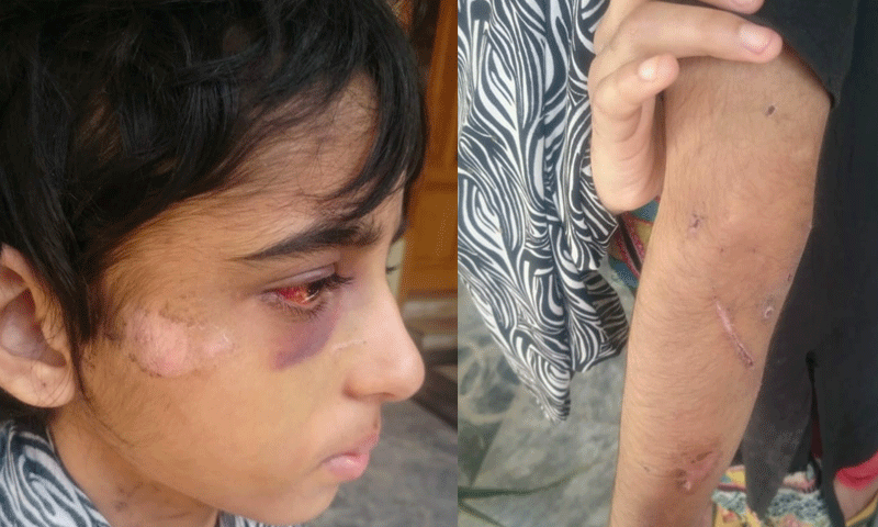 خاتون سرکاری افسر اور خاوند کاکمسن بچی پر بدترین تشدد