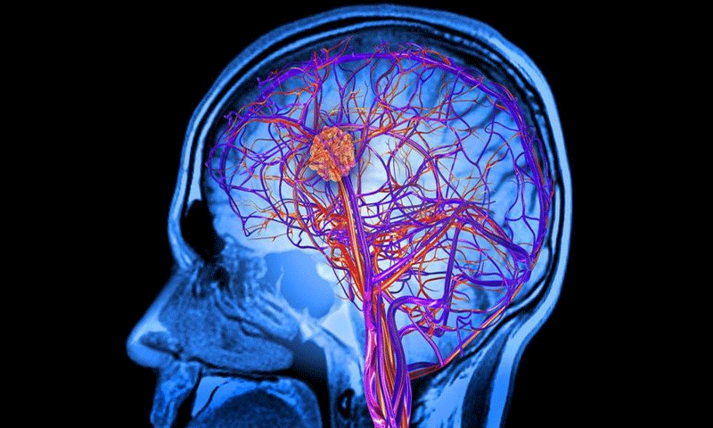 زہنی دباو صحت کے علاوہ دماغ کے لیے بھی مظہر ہے،ریسرچ|urdurevamp.wpenginepowered.com