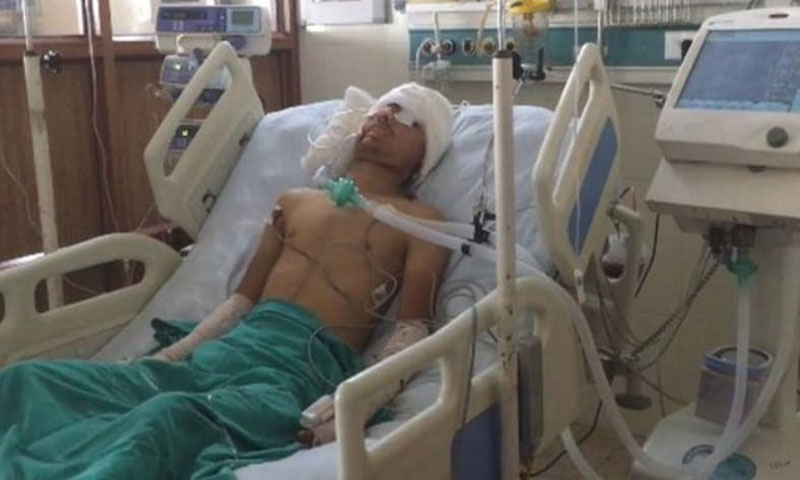 بھارتی افواج نے پیلٹ گنز سے کشمیریوں کو بے نور کرنا شروع کردیا