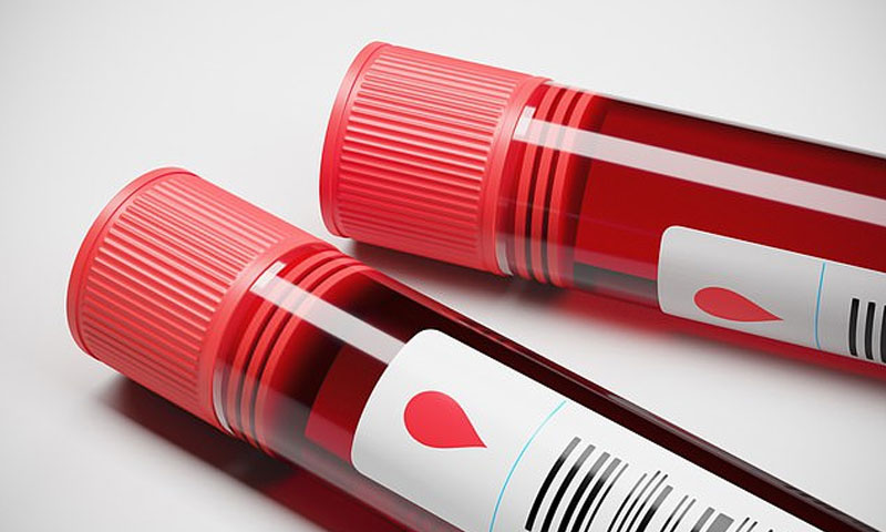 امریکہ میں خون کا بحران پیدا ہو گیا