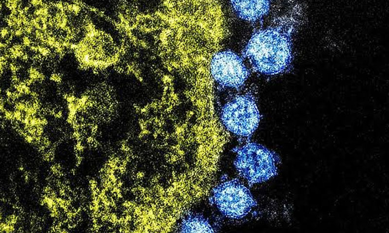 کوروناوائرس کے اثرات صحتیاب ہونے بعد بھی ختم نہیں ہوتے، برطانوی ڈاکٹرز