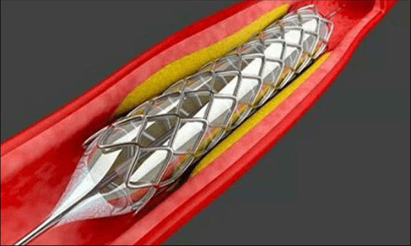 نسٹ کو کارڈیک اسٹنٹ بنانے کا لائسنس جاری