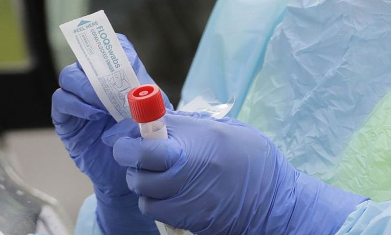 کورونا کے فعال کیسز میں سے 139 مریضوں کی حالت زیادہ خراب ہے