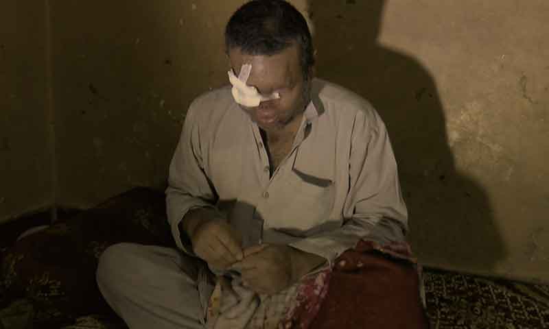 جان داؤ پر لگا کر خواتین کو تیزاب گردی سے بچانے والا رکشہ ڈرائیور بینائی سے محروم