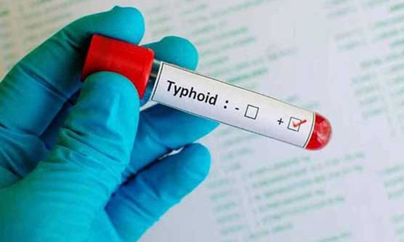 ٹائیفائیڈ کی ادویات بے اثر ہونے لگیں: صورتحال سنگین ہوگئی
