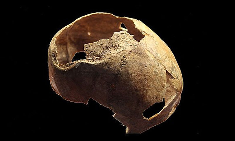 پانچ ہزار سال قبل ناکام آپریشن سے مرنے والے شخص کی کھوپڑی دریافت