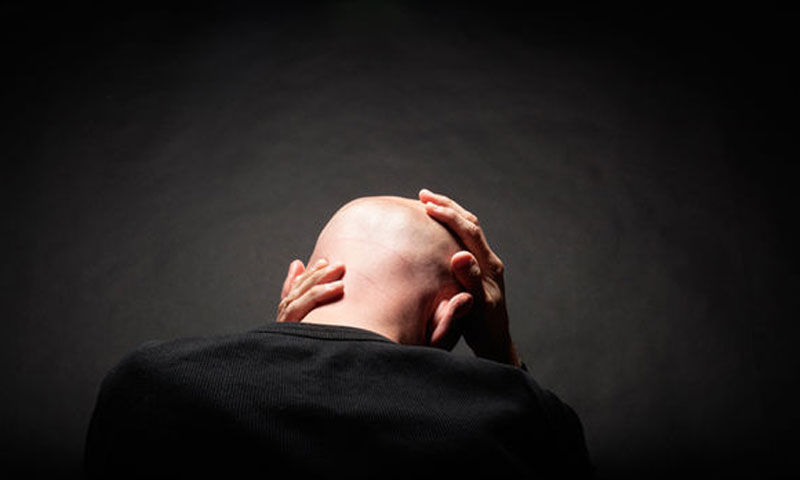 بھارت: خاتون نے گنج پن کی وجہ سے شوہر کیخلاف مقدمہ درج کرا دیا