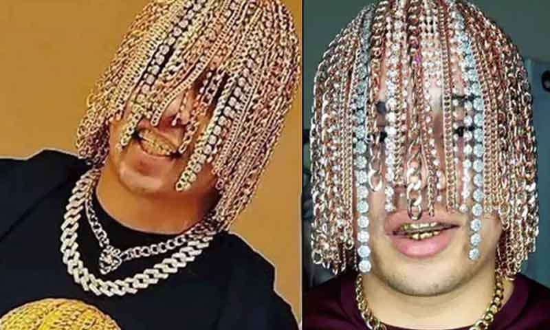 سر پر بالوں کی جگہ ہیرے اور سونا