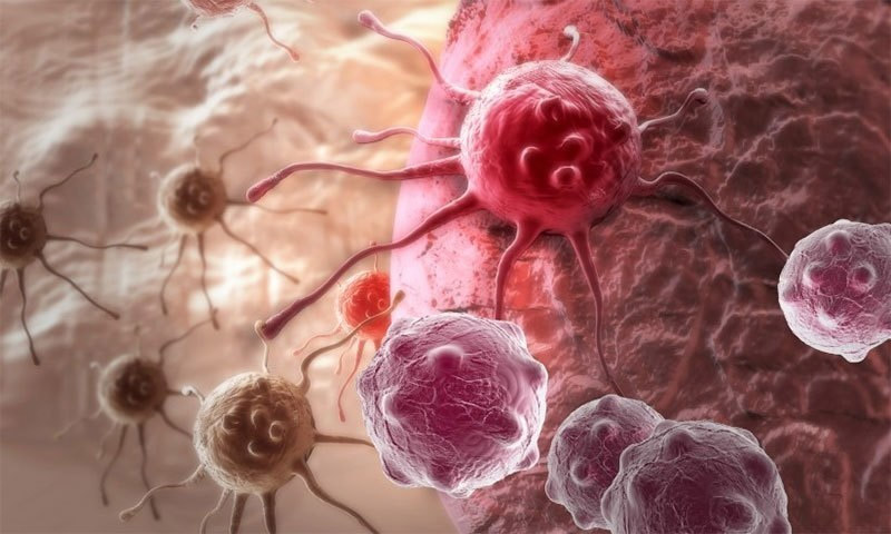 پاکستان میں طبی انقلاب، صرف 60 منٹ میں کینسر کا مکمل خاتمہ ہو گا