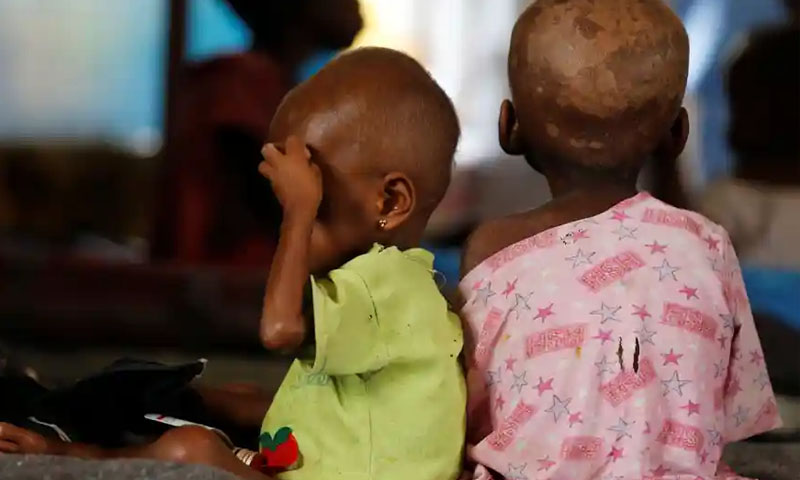 غذائی قلت کے باعث80 لاکھ کم سن بچےموت کے خطرے سے دوچار