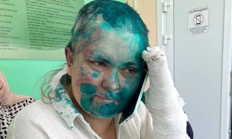 روسی خاتون صحافی پر بہیمانہ تشدد، مار پیٹ کے بعد انگلیاں توڑ دیں، اسپتال منتقل