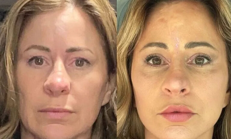 یہ عالم شوق کا۔۔۔! خاتون نے کاسمیٹک سرجری کرانے کیلئے گھر فروخت کر دیا