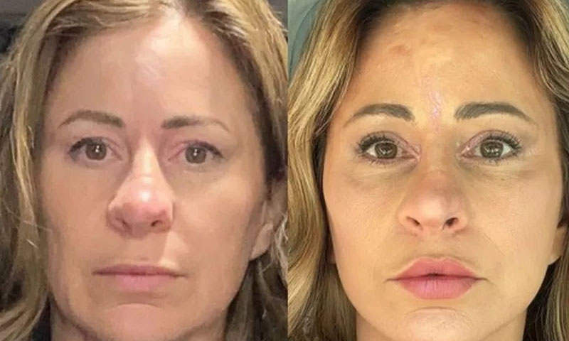 کاسمیٹک سرجری