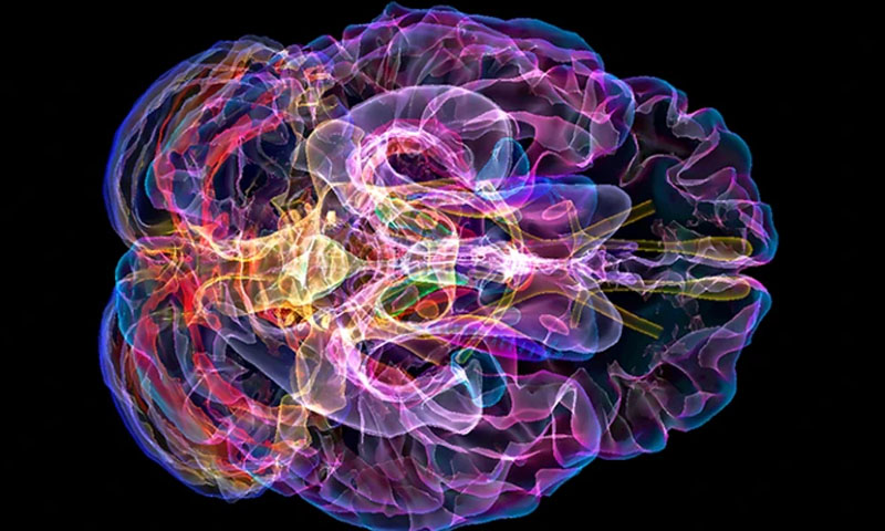 الزائمر کے مریضوں کے لیے خوشخبری، نئی دوا متعارف