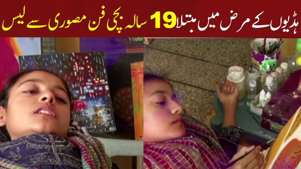 ہڈیوں کے مرض میں مبتلا 19 سالہ بچی فن مصوری سے لیس