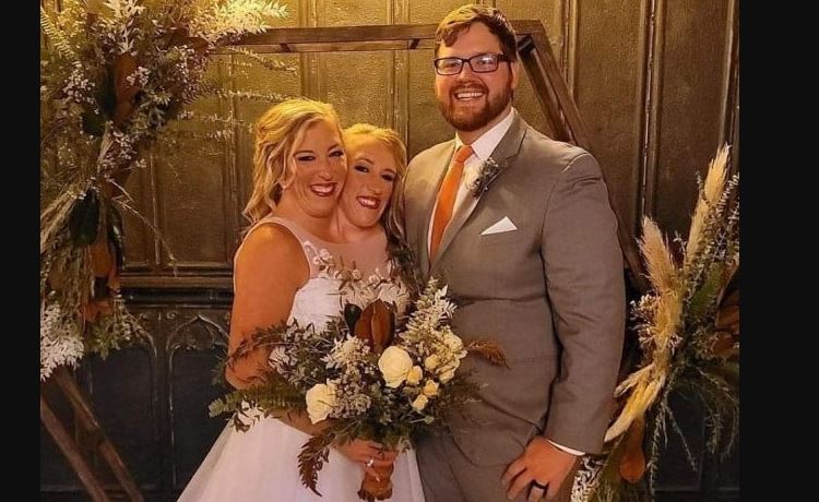 2 سر اور ایک دھڑ والی بہنوں کی امریکی فوجی سے شادی