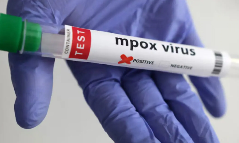 ایم پاکس کیس