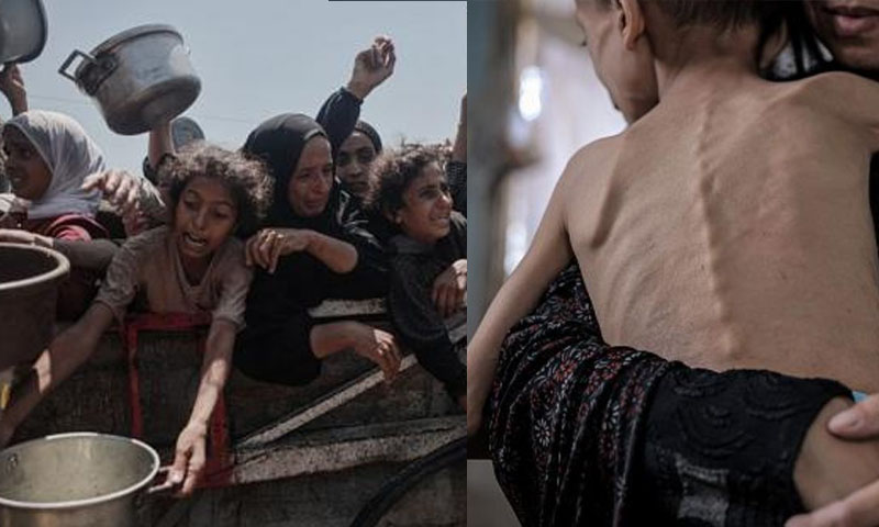 خوراک کی قلت