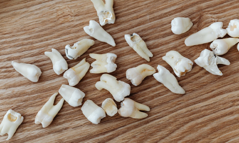 کیا تیزی سے گرنے والے دانت، موت کے خطرے کا اشارہ ہے؟