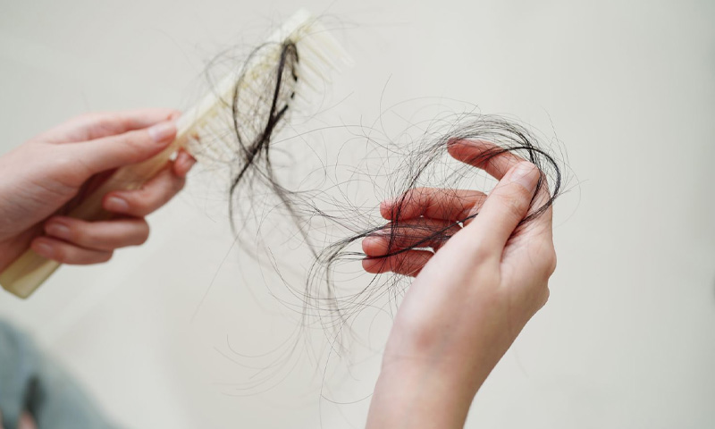 بالوں کو جھڑنے سے بچانے کے لیے کن غذاؤں سے پرہیز ضروری ہے؟