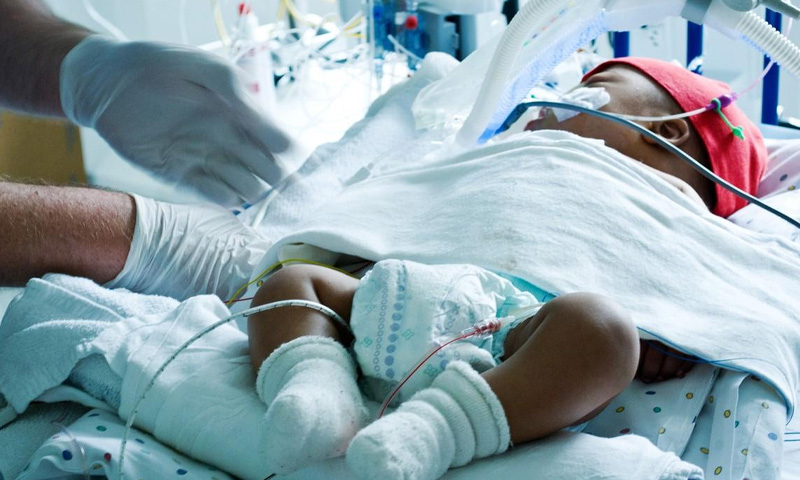 قبل از وقت پیدا ہونے والے بچوں میں دماغی نشوونما سے متعلق اہم دریافت