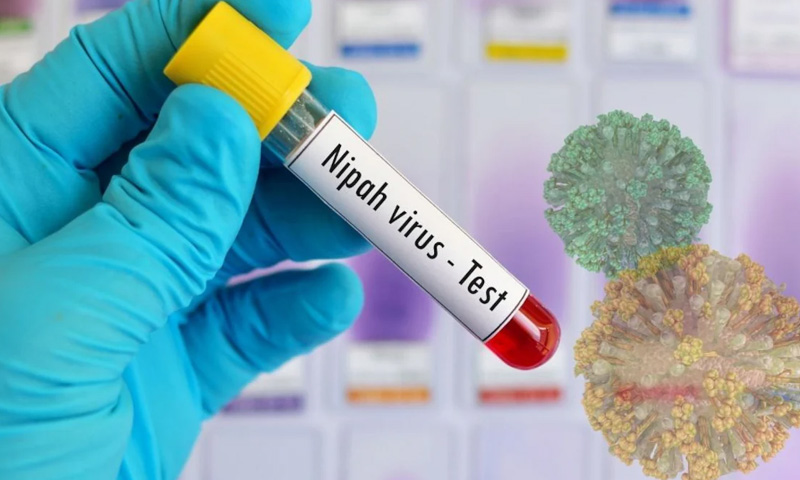 جان لیوا نیپا وائرس کیا ہے؟ علامات، علاج اور حفاظتی اقدامات