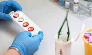 کون سا بلڈ گروپ کینسر کے امکان کو بڑھا سکتا ہے؟