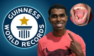 انسانی تاریخ میں سب سے زیادہ دانت رکھنے کا عالمی ریکارڈ