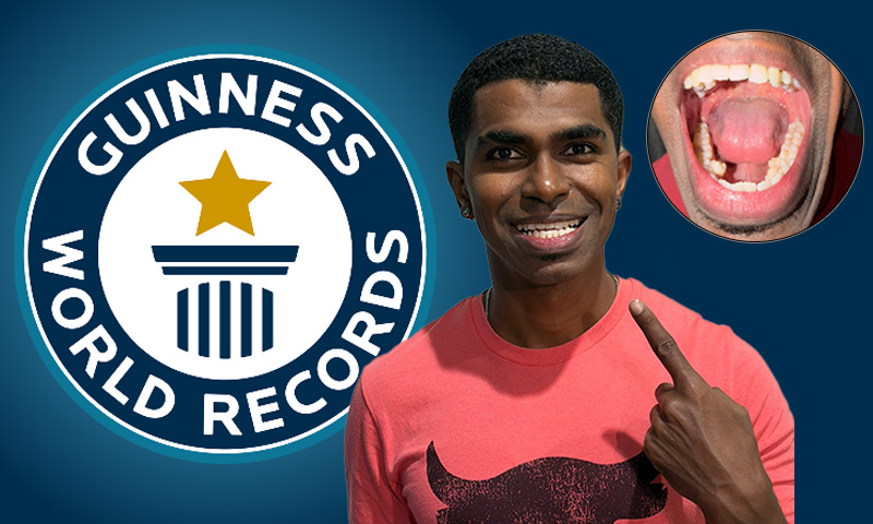انسانی تاریخ میں سب سے زیادہ دانت رکھنے کا عالمی ریکارڈ