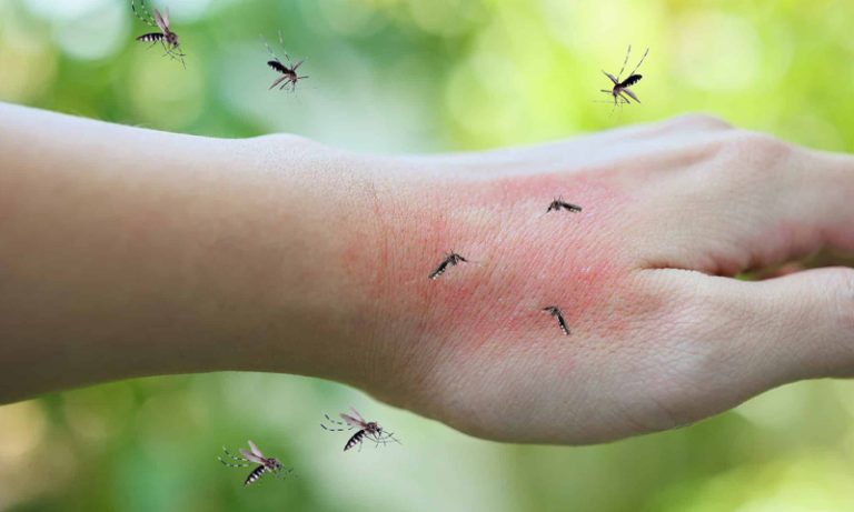 مچھر بعض افراد کو زیادہ کیوں کاٹتے ہیں؟ سائنسی وجوہات سامنے آگئیں