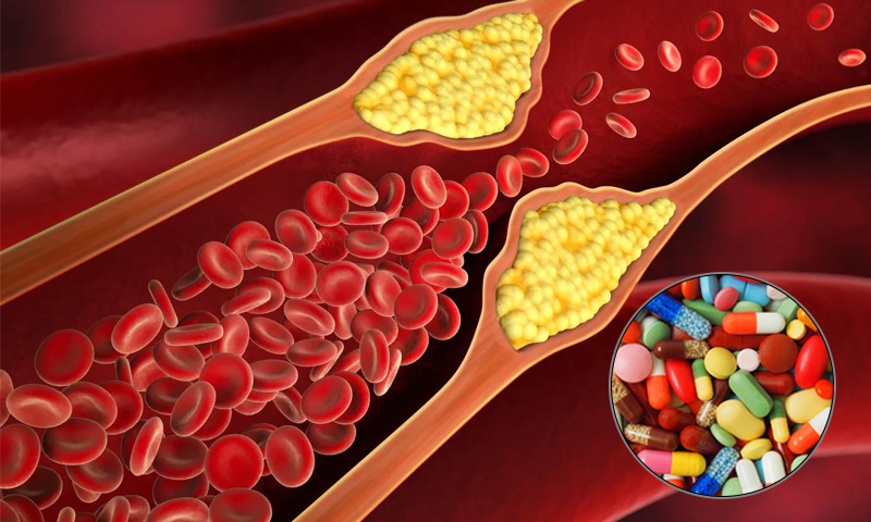 کولیسٹرول ادویات کے صحت پر خطرناک اثرات، ماہرین کی وارننگ