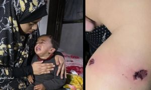 غزہ میں دل دہلا دینے والا واقعہ ، اسرائیلی فوج نے معصوم بچے کو سگریٹ سے داغ دیا