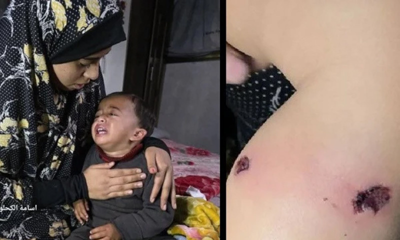 غزہ میں دل دہلا دینے والا واقعہ ، اسرائیلی فوج نے معصوم بچے کو سگریٹ سے داغ دیا