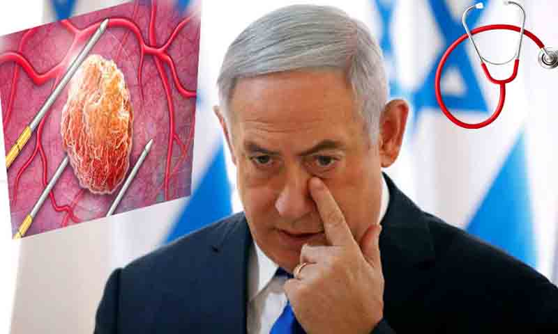 نیتن یاہو میں پروسٹیٹ کینسر کی تشخیص کے بعد علاج