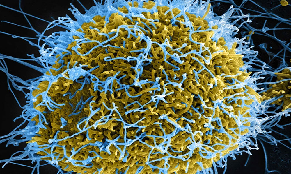 Ebola Virus